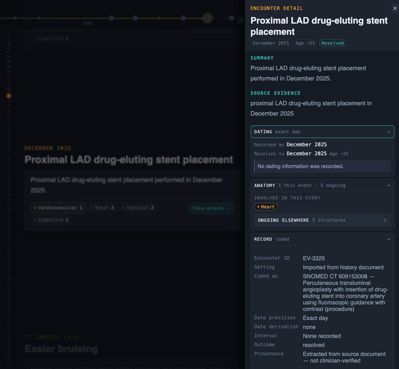 An encounter detail panel for a December 2025 coronary stent placement, showing the plain-language summary, the source text it was extracted from, how the date was resolved, the heart as the structure involved, the SNOMED CT concept it was coded to, and a provenance line marking it as extracted rather than clinician-verified